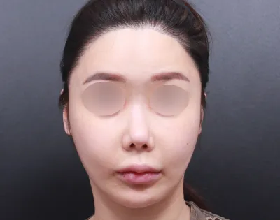 我手術只在這邊做.. 院長們很有責任感，職員們也真的很親切。