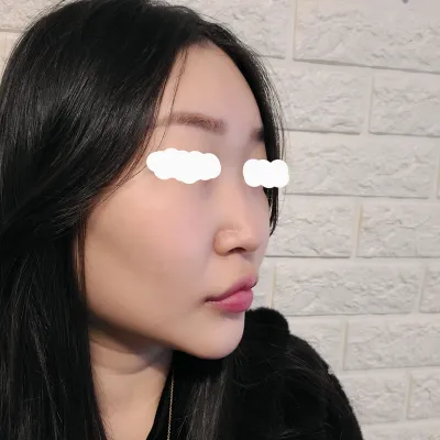 感謝幫我打造漂亮鼻子的林英敏院長，以及治好我鼻炎的南在成院長，謝謝你們唷～