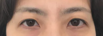 大家都說我感覺變了，一直問我是哪間醫院跟哪位院長，哈哈。