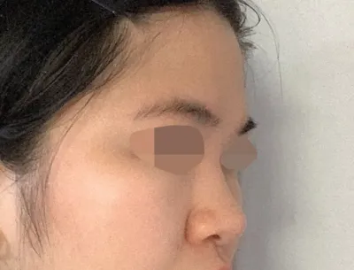 真的明白為什麼會有「醫神」這個稱呼了，超級滿意！！