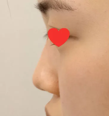 我非常喜歡，身邊的人也都誇漂亮到不行。