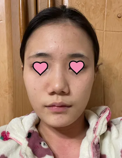 真的非常感謝您彌補了我所有的缺點，幫我打造了完美的鼻子！