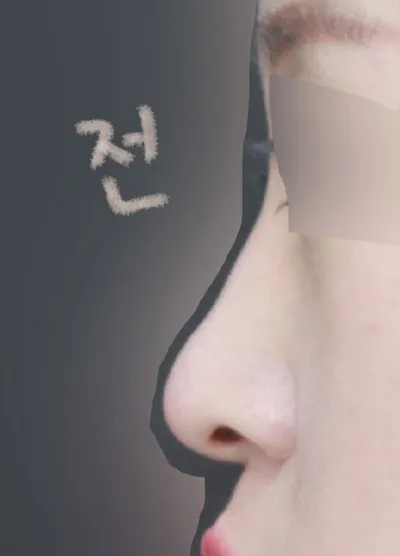 真的很感謝院長幫我做得這麼自然！