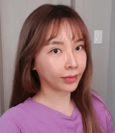 做了胸部和雙下巴抽脂、全臉脂肪填充、拉提。