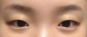 現在非常舒服也很滿意！