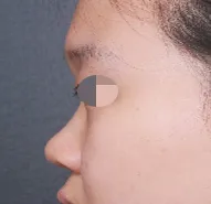 非常感謝林永敏院長～我想向和我有一樣煩惱的人強力推薦～^^