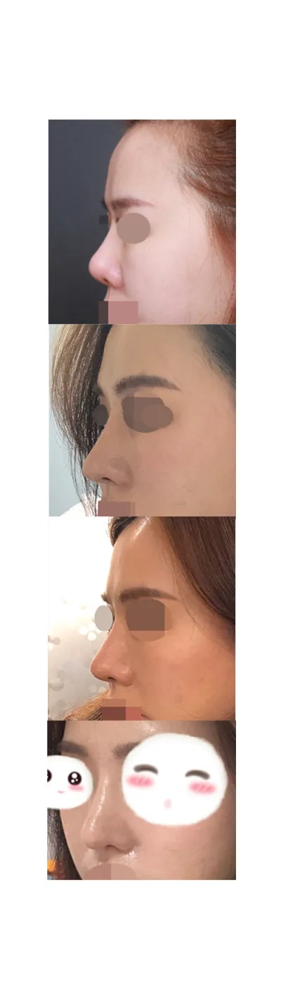 身邊的人都說自然的樣子好得多。