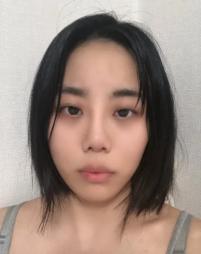 大家做眼部整形一定要去 Very Good！！真的不推薦不行。