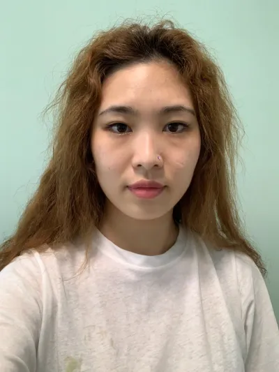 在 Very Good 做了眼睛、鼻子、臉部輪廓手術，留下後記了~~~！！