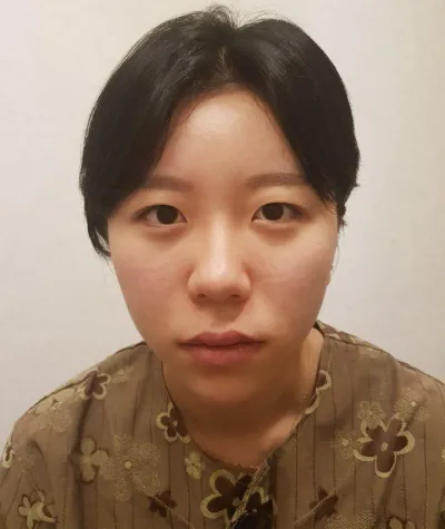 還在猶豫要不要做雙眼皮的人，請一定要去做！