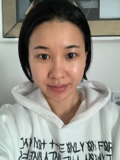 手術已經過了6個月了！來分享心得囉～