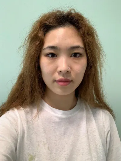 眼睛、鼻子、下顎角手術心得來了~~