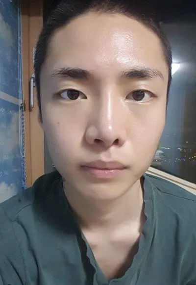 大家好~~ 這是眼睛手術及鼻子重修手術的心得！！