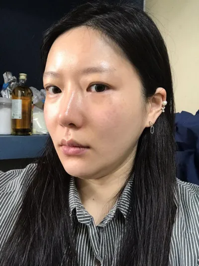 這是施作三週後的心得唷～