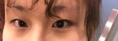找到了雙眼皮的人生診所！！