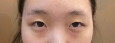 是在 Very Good 整形外科的金俊賢院長那裡做的唷。