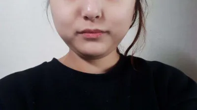 做了人生第一次抽脂！