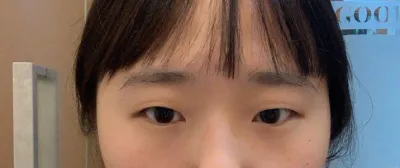 覺得割雙眼皮真是割對了ㅠㅠ