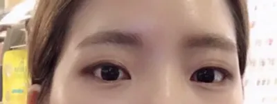 這是割雙眼皮5~6週左右的心得哈哈哈