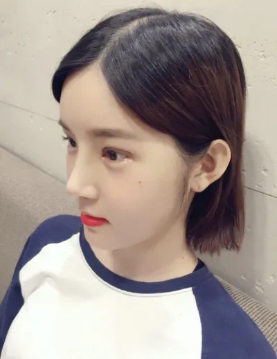 顴骨手術第2週了！！