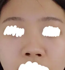 謝謝朴相旭院長ㅠㅠ