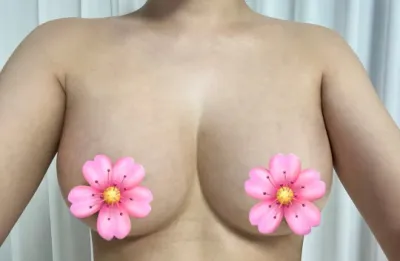 Melon 金周源院長 魔滴 終於滿一個月！心得