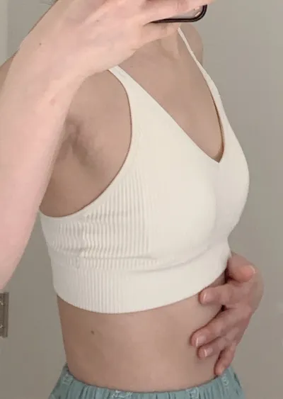 隆乳手術滿兩個月心得 (魔滴 / 355cc / 胸下切口)