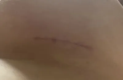 因為針對我的胸型給予了誠實的諮詢，所以預約了☺️