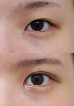 After