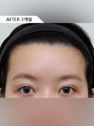 After