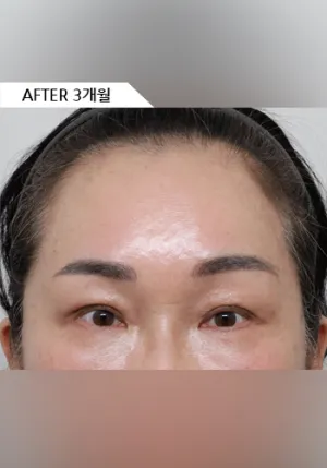After
