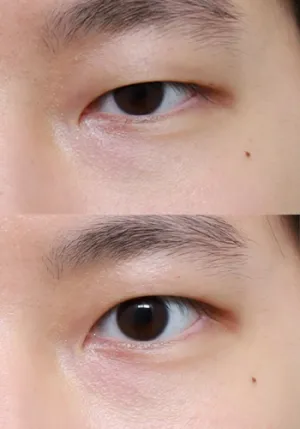 After