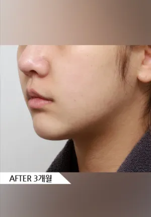 After