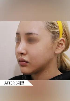 After