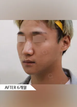 After