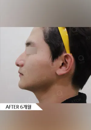 After