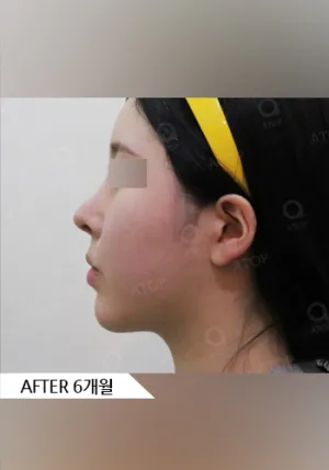 After