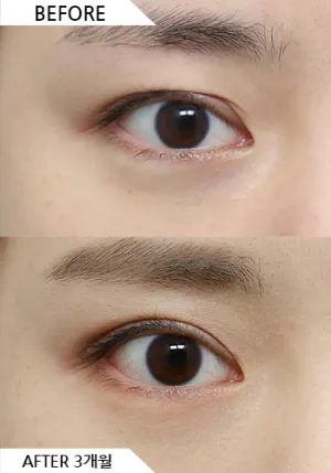 Before