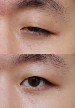 After