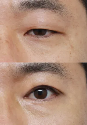 After