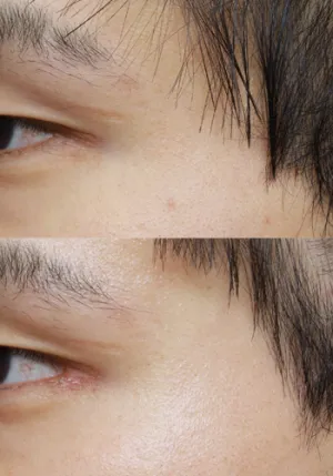 After