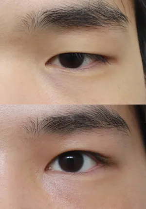 After