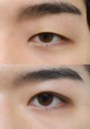 After