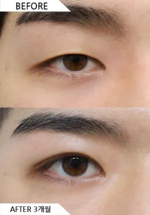 Before