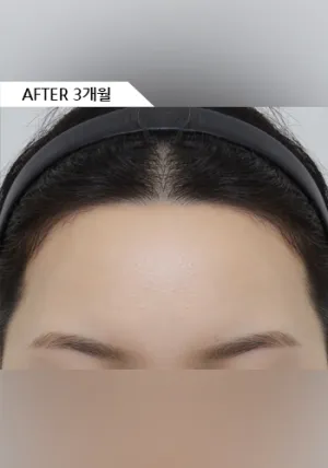 After