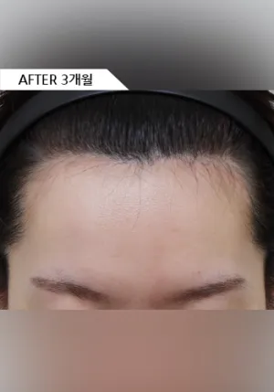 After