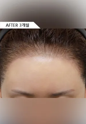After