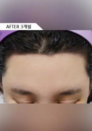 After