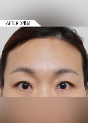 After