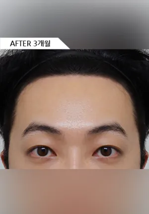 After